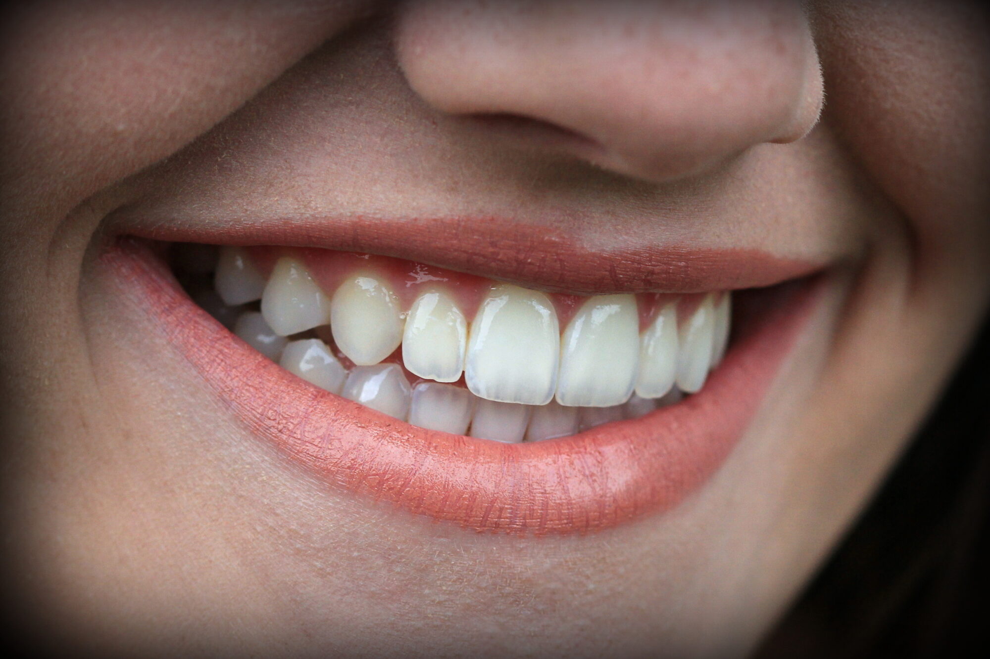 We often encounter various dental challenges. Let's enter a world where the precision of orthodontics meets the artistry of prosthodontics.