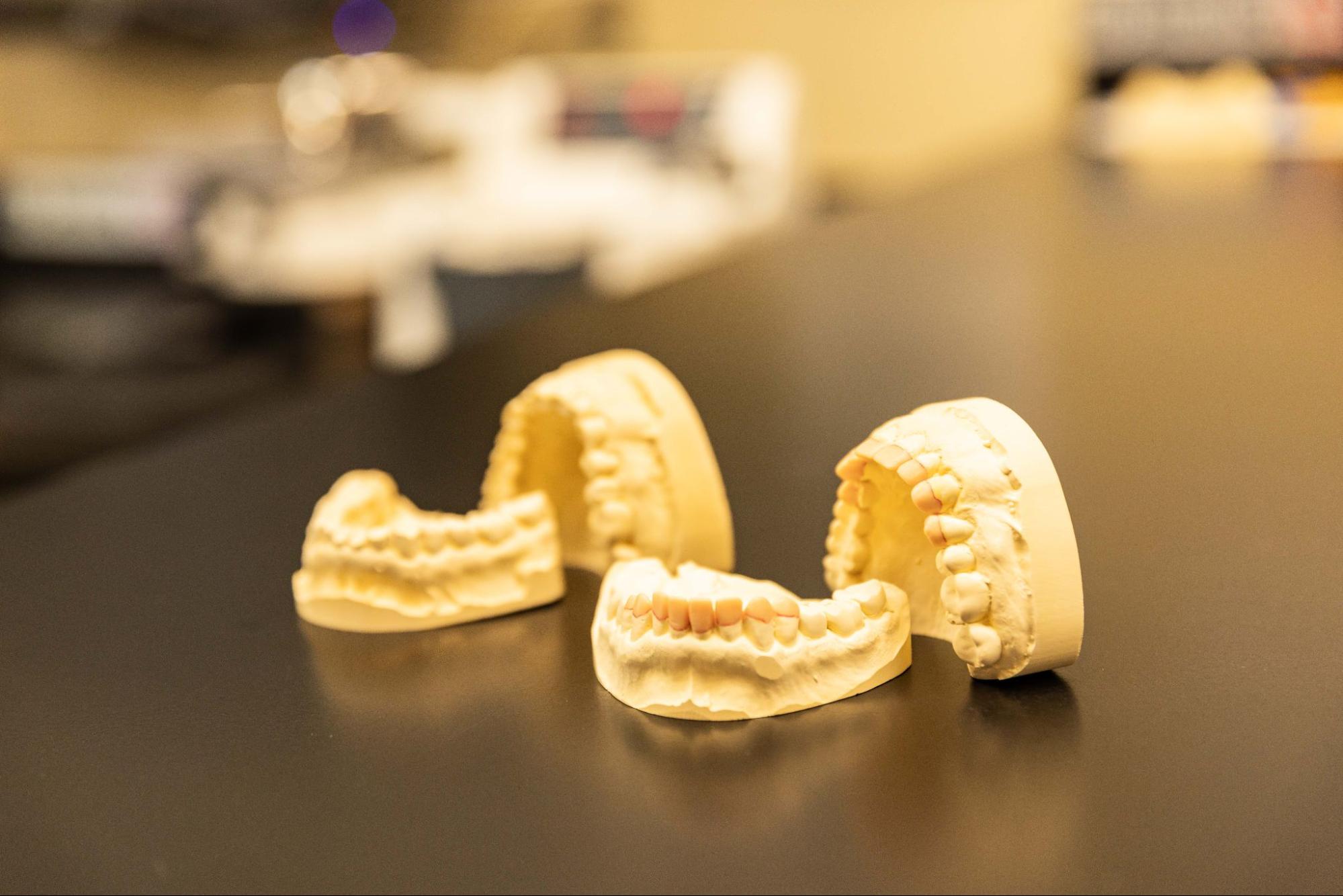 How Does 3D Printing Work in Orthodontic Treatment?